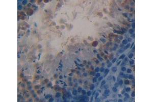 #VALUE! (HSD17B3 antibody  (AA 1-310))