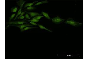 Immunofluorescence of purified MaxPab antibody to ZFP36 on HeLa cell. (ZFP36 antibody  (AA 1-326))