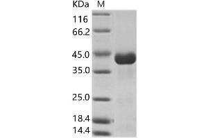 Western Blotting (WB) image for Chikungunya Virus E2 Protein (CHIKV E2) protein (His tag) (ABIN7198886) (Chikungunya Virus E2 Protein (CHIKV E2) protein (His tag))