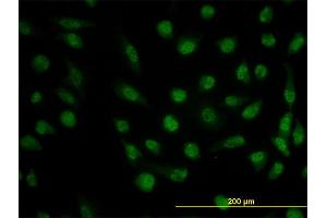 Immunofluorescence of monoclonal antibody to DHFR on HeLa cell. (Dihydrofolate Reductase antibody  (AA 88-187))