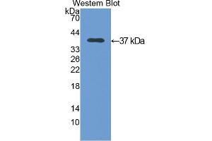 Western blot analysis of the recombinant protein. (Annexin V antibody  (AA 1-319))
