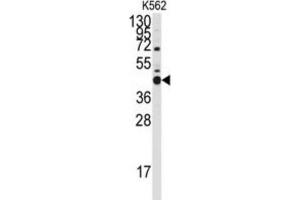 Western Blotting (WB) image for anti-BCL2-Like 14 (Apoptosis Facilitator) (BCL2L14) (BH3 Domain) antibody (ABIN2997105) (BCL2L14 antibody  (BH3 Domain))
