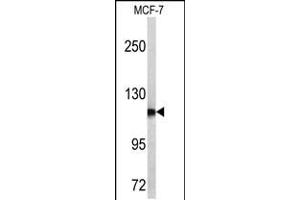Western blot analysis of PSA antibody in MCF-7 cell line lysates (35ug/lane) (Prostate Specific Antigen antibody  (C-Term))