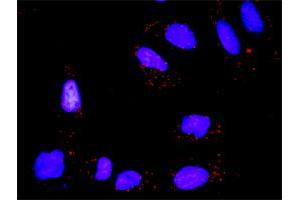Proximity Ligation Analysis of protein-protein interactions between TP53 and CSNK2A1. (CSNK2A1/CK II alpha antibody  (AA 1-100))