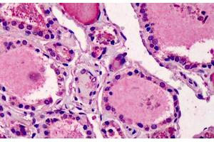 Human Thyroid: Formalin-Fixed, Paraffin-Embedded (FFPE) (DIDO1 antibody  (AA 72-121))