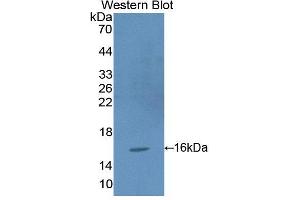 Figure. (PRO-ANP antibody  (N-Term))