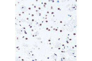 Immunohistochemistry of paraffin-embedded mouse brain using Symmetric DiMethyl-Histone H3-R2 antibody (ABIN3016053, ABIN3016054, ABIN3016055, ABIN1680220 and ABIN6219534) at dilution of 1:100 (40x lens). (Histone 3 antibody  (H3R2me2))