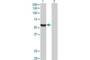 Western Blot analysis of AGER expression in transfected 293T cell line by AGER monoclonal antibody (M02C), clone 1C1. (RAGE antibody  (AA 23-404))