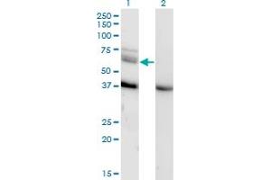 Western Blot analysis of MAP3K7 expression in transfected 293T cell line by MAP3K7 monoclonal antibody (M04), clone 3C9. (MAP3K7 antibody  (AA 471-579))