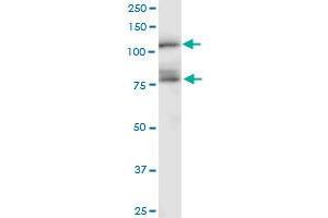 CDH11 monoclonal antibody (M04), clone 1A5. (OB Cadherin antibody  (AA 54-612))