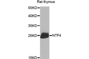 Western blot analysis of extracts of rat thymus, using NTF4 antibody. (Neurotrophin 4 antibody)