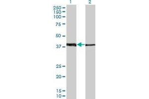 Western Blot analysis of ZNF187 expression in transfected 293T cell line by ZNF187 monoclonal antibody (M01A), clone 1D9.