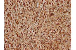 Immunohistochemistry (IHC) image for anti-Mdm2, p53 E3 Ubiquitin Protein Ligase Homolog (Mouse) (MDM2) (AA 374-391) antibody (ABIN7139815)