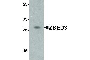 Western Blot of ZBED3 Antibody - Western Blot of ZBED3 antibody. (ZBED3 antibody  (C-Term))