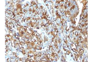 Immunohistochemistry (IHC) image for anti-Mucin 1 (MUC1) antibody (ABIN6940099)