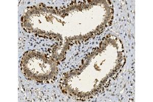 IHC analysis of FOXP1 using anti-FOXP1 antibody (ABIN7602780). (FOXP1 antibody  (C-Term))