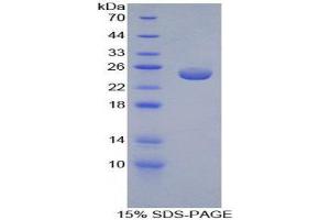 SDS-PAGE (SDS) image for Peroxiredoxin 5 (PRDX5) (AA 1-210) protein (His tag) (ABIN1080500) (Peroxiredoxin 5 Protein (PRDX5) (AA 1-210) (His tag))