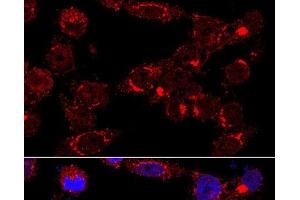 Immunofluorescence analysis of HeLa cells using GM130 Polyclonal Antibody at dilution of 1:400 (60x lens). (Golgin A2 (GOLGA2) antibody)