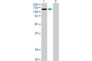 LARP1 antibody  (AA 1-1019)