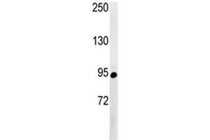 Western Blotting (WB) image for anti-ATP-Binding Cassette, Sub-Family F (GCN20), Member 1 (ABCF1) (AA 687-716) antibody (ABIN5647444)