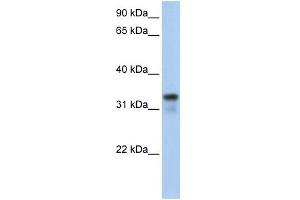 WB Suggested Anti-GLYATL2 Antibody Titration:  0. (GLYATL2 antibody  (Middle Region))