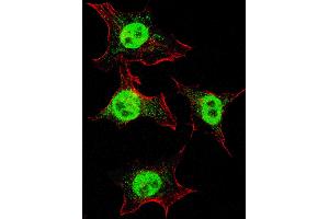 Fluorescent confocal image of HeLa cells stained with ITGA6 (isoform 2 ) antibody.