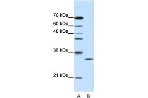 CLIC1 antibody - C-terminal region  validated by WB using purified recombinant CLIC1 protein and transfected lysate