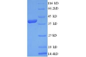 SDS-PAGE (SDS) image for LY6/PLAUR Domain Containing 6 (LYPD6) (AA 23-171) protein (GST tag) (ABIN4974548)