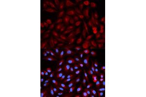 Immunofluorescence analysis of HeLa cell using PSME3 antibody. (PSME3 antibody  (AA 1-254))