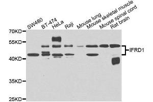 Western blot analysis of extracts of various cell lines, using IFRD1 antibody. (IFRD1 antibody)