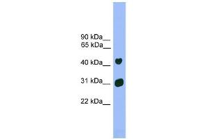WB Suggested Anti-Lhx5 Antibody Titration: 0. (LHX5 antibody  (Middle Region))