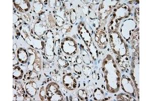 Immunohistochemical staining of paraffin-embedded liver tissue using anti-ERCC1 mouse monoclonal antibody. (ERCC1 antibody)