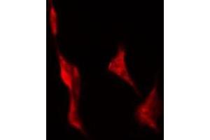 ABIN6278640 staining Hela by IF/ICC. (TAS2R43 antibody)