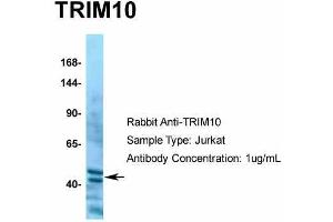 Human Jurkat; Host: Rabbit. (TRIM10 antibody  (C-Term))