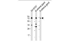 All lanes : Anti-DBH Antibody (N-term P42) at 1:2000 dilution Lane 1: SH-SY5Y whole cell lysate Lane 2: mouse adrenal gland lysate Lane 3: rat adrenal gland lysate Lysates/proteins at 20 μg per lane.