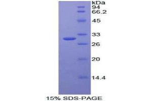 SDS-PAGE (SDS) image for Low Density Lipoprotein Receptor-Related Protein 3 (LRP3) (AA 184-435) protein (His tag) (ABIN2125720) (LRP3 Protein (AA 184-435) (His tag))
