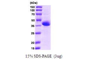 SDS-PAGE (SDS) image for Stromal Interaction Molecule 1 (STIM1) (AA 23-213) protein (CaM) (ABIN666653) (STIM1 Protein (AA 23-213) (CaM))