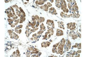 RHOT1 antibody was used for immunohistochemistry at a concentration of 4-8 ug/ml to stain Skeletal muscle cells (arrows) in Human Muscle. (RHOT1 antibody  (N-Term))