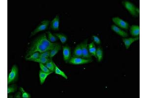 Immunofluorescent analysis of HepG2 cells using ABIN7174961 at dilution of 1:100 and Alexa Fluor 488-congugated AffiniPure Goat Anti-Rabbit IgG(H+L) (Myosin VIIA antibody  (AA 838-968))