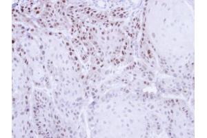 IHC-P Image Immunohistochemical analysis of paraffin-embedded Cal27 Xenograft , using CSE1L, antibody at 1:500 dilution. (Exportin 2 antibody  (Center))