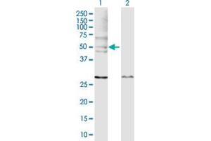 Western Blot analysis of WASL expression in transfected 293T cell line by WASL MaxPab polyclonal antibody. (Neural Wiskott-Aldrich syndrome protein (WASL) (AA 1-505) antibody)