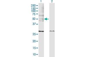 Western Blot analysis of WASL expression in transfected 293T cell line by WASL MaxPab polyclonal antibody. (Neural Wiskott-Aldrich syndrome protein (WASL) (AA 1-505) antibody)