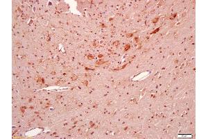 BBS5 antibody  (AA 220-270)