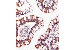 Immunohistochemical analysis of paraffin-embedded H. (ATP5B antibody  (AA 135-163))