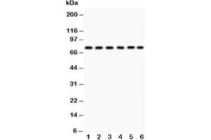 Western blot testing of PKC delta antibody and Lane 1:  HeLa;  2: SMMC-7721;  3: U87;  4: Jurkat;  5: CEM;  6: A549;  Predicted size: 77KD;  Observed size: 77KD (PKC delta antibody  (AA 1-160))