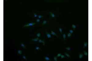 Image no. 1 for anti-Cancer/testis Antigen 1B (CTAG1B) antibody (ABIN1499903)