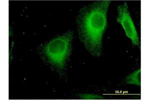 Immunofluorescence of monoclonal antibody to STAB1 on HeLa cell. (Stabilin 1 antibody  (AA 1804-1902))