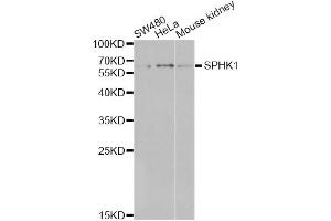 Western blot analysis of extracts of various cell lines, using SPHK1 antibody. (SPHK1 antibody)