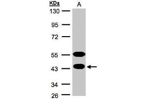 WB Image Sample(30 ug whole cell lysate) A:MOLT4 , 10% SDS PAGE antibody diluted at 1:1000 (CABS1 antibody  (Center))