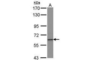 Image no. 1 for anti-Zinc Finger Protein 37A (ZNF37A) (AA 1-257) antibody (ABIN1501840)